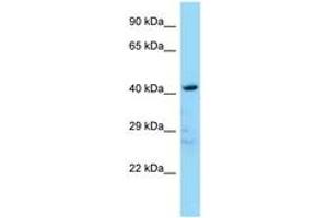 Image no. 1 for anti-LIM Domain Binding 2 (LDB2) (N-Term) antibody (ABIN6748324) (LIM Domain Binding 2 Protein antibody  (N-Term))