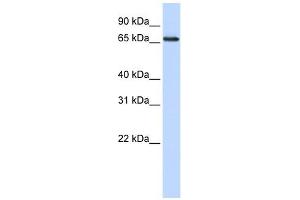 WDSOF1 antibody used at 1 ug/ml to detect target protein. (DCAF13 antibody  (N-Term))