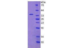 Image no. 1 for Janus Kinase 2 (JAK2) (AA 508-800) (Active) protein (His tag) (ABIN6239839)