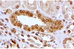 ABIN5539467 (2µg/ml) staining of paraffin embedded Human Kidney. (Aryl Hydrocarbon Receptor antibody  (Internal Region))