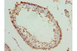 Immunohistochemistry of paraffin-embedded human testis tissue using ABIN7166711 at dilution of 1:100 (MOV1 (AA 601-900) antibody)