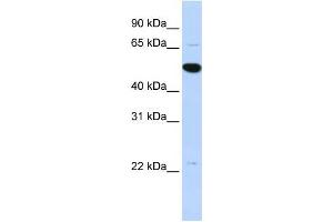 Human MCF-7; WB Suggested Anti-RP13-102H20. (ARHGAP36 antibody  (Middle Region))