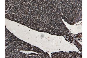 Immunohistochemistry (IHC) image for anti-Desmin (DES) (C-Term) antibody (ABIN334386)