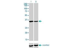 Western blot analysis of FMR1 over-expressed 293 cell line, cotransfected with FMR1 Validated Chimera RNAi (Lane 2) or non-transfected control (Lane 1). (FMR1 antibody  (AA 121-220))