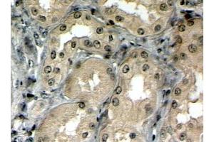 Immunohistochemistry (IHC) image for anti-ATP-Binding Cassette, Sub-Family C (CFTR/MRP), Member 5 (ABCC5) (N-Term) antibody (ABIN302162)