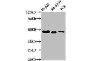 Western Blot Positive WB detected in: HepG2 whole cell lysate, SH-SY5Y whole cell lysate, PC-3 whole cell lysate All lanes: CXorf36 antibody at 3. (CXORF36 antibody  (AA 311-405))