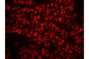 Immunofluorescence (IF) image for anti-Replication Protein A2, 32kDa (RPA2) (pSer4), (pSer8) antibody (ABIN7449013) (RPA2 antibody  (pSer4, pSer8))