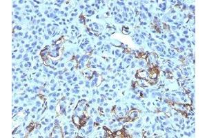 Immunohistochemistry (IHC) image for anti-Nerve Growth Factor Receptor (NGFR) antibody (ABIN3025052)