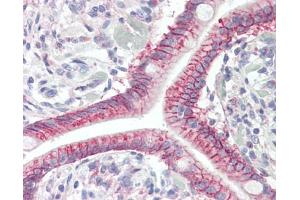 Anti-GPR52 antibody IHC staining of human small intestine.