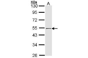 WB Image Sample (30 ug of whole cell lysate) A: 293T 10% SDS PAGE antibody diluted at 1:1000 (RNF13 antibody  (C-Term))