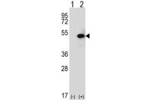 Western blot analysis of SPHK1 antibody and 293 cell lysate (2 ug/lane) either nontransfected (Lane 1) or transiently transfected (2) with the SPHK1 gene.