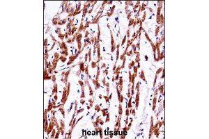 Immunohistochemistry (Formalin/PFA-fixed paraffin-embedded sections) of human heart tissue with TMEM85 polyclonal antibody  followed by peroxidase conjugation of the secondary antibody and DAB staining. (EMC4 antibody  (AA 34-62))
