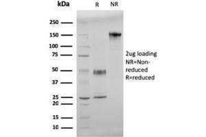 SDS-PAGE Analysis Purified Double Stranded DNA Mouse Monoclonal Antibody (121-3). (dsDNA antibody)