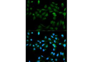 Immunofluorescence analysis of MCF7 cell using CYP11A1 antibody. (CYP11A1 antibody  (AA 40-320))