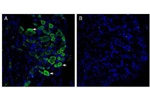 Expression of GPR35 in rat dorsal root ganglion. (GPR35 antibody  (Extracellular))