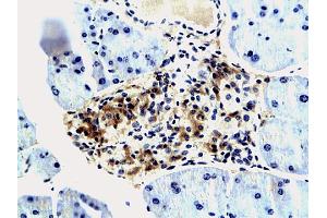 Immunohistochemistry (IHC) image for anti-Insulin-Like Growth Factor 2 mRNA Binding Protein 3 (IGF2BP3) (AA 101-230) antibody (ABIN674814)