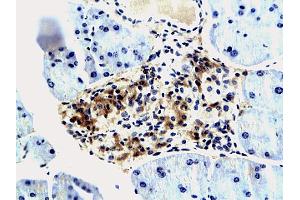 Formalin-fixed and paraffin embedded mouse pancreas tissue labeled with Anti IMP3 IGF-IIBP3 Polyclonal Antibody, unconjugated (ABIN674814) at 1:200 followed by incubation with conjugated secondary antibody and DAB staining