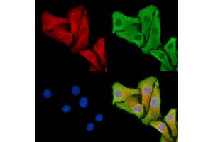ABIN7095318 and ABIN7099375 staining Hela cells by IF/ICC. (SNX33 antibody)