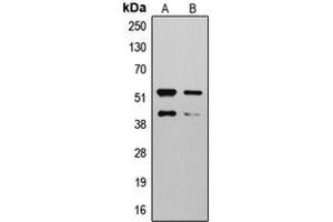 Western blot analysis of MMP10 expression in HepG2 (A), NIH3T3 (B) whole cell lysates. (MMP10 antibody  (Center))