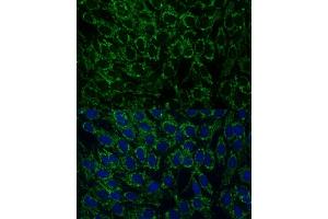 Immunofluorescence (IF) image for anti-Mitochondrial Translational Initiation Factor 2 (MTIF2) (AA 428-727) antibody (ABIN7268591)