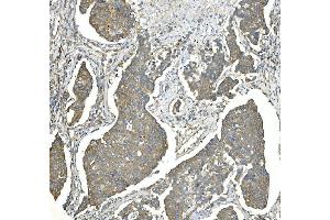 IHC analysis of EEF2 using anti-EEF2 antibody (ABIN7603141).