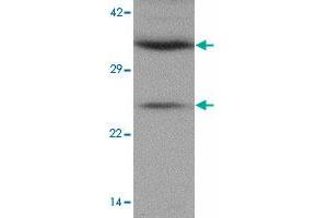 Western blot analysis of CXXC5 in human brain tissue lysate with CXXC5 polyclonal antibody  at 1 ug/mL. (CXXC5 antibody  (N-Term))