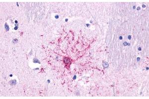 Anti-NTSR2 antibody  ABIN1049157 IHC staining of human brain, protoplasmic astrocyte.
