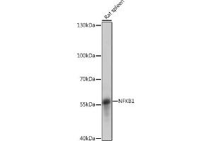 Western blot analysis of extracts of Rat spleen, using NFKB1 antibody (ABIN7268980) at 1:1000 dilution.