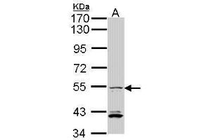 WB Image Sample (30 ug of whole cell lysate) A: Hep G2 , 7. (IRF5 antibody  (C-Term))