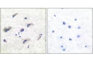 Immunohistochemistry (IHC) image for anti-Microtubule-Associated Protein tau (MAPT) (pSer356) antibody (ABIN2888546) (MAPT antibody  (pSer356))