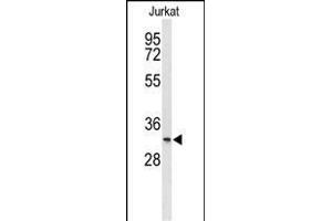 Western blot analysis of T150A Antibody (Center) (ABIN653313 and ABIN2842808) in Jurkat cell line lysates (35 μg/lane).
