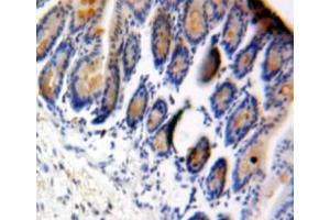 Used in DAB staining on fromalin fixed paraffin-embedded bowels tissue (eIF4EBP1 antibody  (AA 2-117))