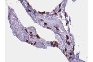 ABIN6267424 at 1/100 staining human lung tissue sections by IHC-P. (ELK1 antibody  (pSer389))