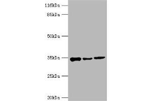 Western blot All lanes: AQP4 antibody at 2 μg/mL Lane 1: Mouse heart tissue Lane 2: Mouse brain tissue Lane 3: Mouse kidney tissue Secondary Goat polyclonal to rabbit IgG at 1/10000 dilution Predicted band size: 35, 33 kDa Observed band size: 35 kDa