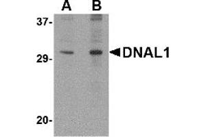 Western Blotting (WB) image for anti-Dynein, Axonemal, Light Chain 1 (DNAL1) (C-Term) antibody (ABIN1030363) (DNAL1 antibody  (C-Term))