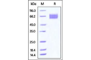 SDS-PAGE (SDS) image for Epidermal Growth Factor Receptor (EGFR) (AA 25-378) (Active) protein (His tag) (ABIN4949096)
