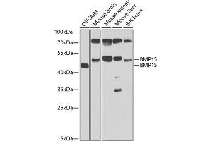 Western blot analysis of extracts of various cell lines, using BMP15 antibody (ABIN6127524, ABIN6137593, ABIN6137594 and ABIN6223163) at 1:1000 dilution. (BMP15 antibody  (AA 143-392))