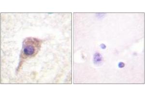 Immunohistochemistry analysis of paraffin-embedded human brain, using PKC zeta (Phospho-Thr560) Antibody. (PKC zeta antibody  (pThr560))