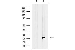 anti-Mitochondrial Ribosomal Protein S28 (MRPS28) (C-Term) antibody