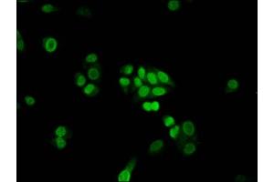 Immunofluorescence staining of PC-3 cells with ABIN7152540 at 1:100, counter-stained with DAPI. (FANCB antibody  (AA 431-574))