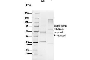 SDS-PAGE Analysis Purified CD79b Mouse Monoclonal Antibody (B29/123). (CD79b antibody  (C-Term))