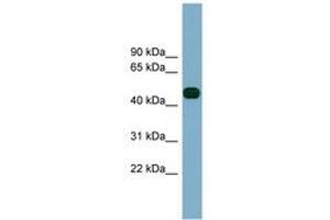 Image no. 1 for anti-Abhydrolase Domain Containing 12 (ABHD12) (AA 323-372) antibody (ABIN6743342) (ABHD12 antibody  (AA 323-372))