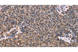 EVC2 antibody