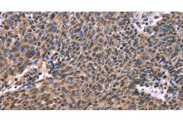 EVC2 antibody