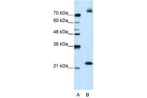 FZD9 antibody used at 2. (FZD9 antibody)