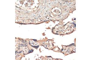 Immunohistochemistry of paraffin-embedded human placenta using MSP/MST1 antibody (ABIN6132374, ABIN6144095, ABIN6144096 and ABIN6216790) at dilution of 1:200 (40x lens). (MST1 antibody  (AA 200-500))
