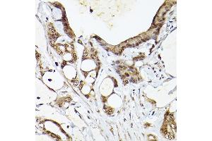 Immunohistochemistry of paraffin-embedded human colon carcinoma using UBQLN4 Rabbit pAb (ABIN7271124) at dilution of 1:150 (40x lens). (UBQLN4 antibody  (AA 300-390))
