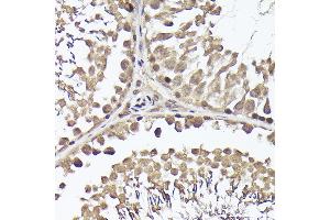 Immunohistochemistry of paraffin-embedded rat testis using METTL4 Rabbit pAb (ABIN6133091, ABIN6143773, ABIN6143774 and ABIN6224964) at dilution of 1:100 (40x lens). (METTL4 antibody  (AA 1-190))