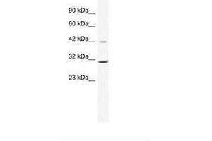 Image no. 1 for anti-Cyclin D3 (CCND3) (C-Term) antibody (ABIN6735965) (Cyclin D3 antibody  (C-Term))