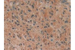 Immunohistochemistry (IHC) image for anti-Hypoxanthine phosphoribosyltransferase 1 (HPRT1) (AA 3-218) antibody (ABIN7432454)